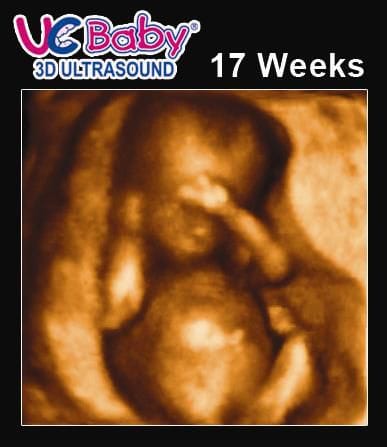 3d Ultrasound Archives Urban Mommies