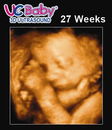 3d Ultrasound Archives Urban Mommies