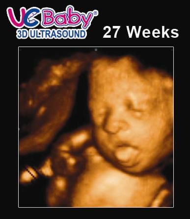 3d Ultrasound Archives Urban Mommies